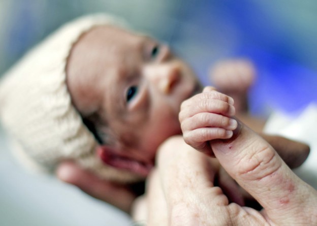 A premature baby at Groote Schuur hospital. Photo: Henk Kruger/Cape Argus